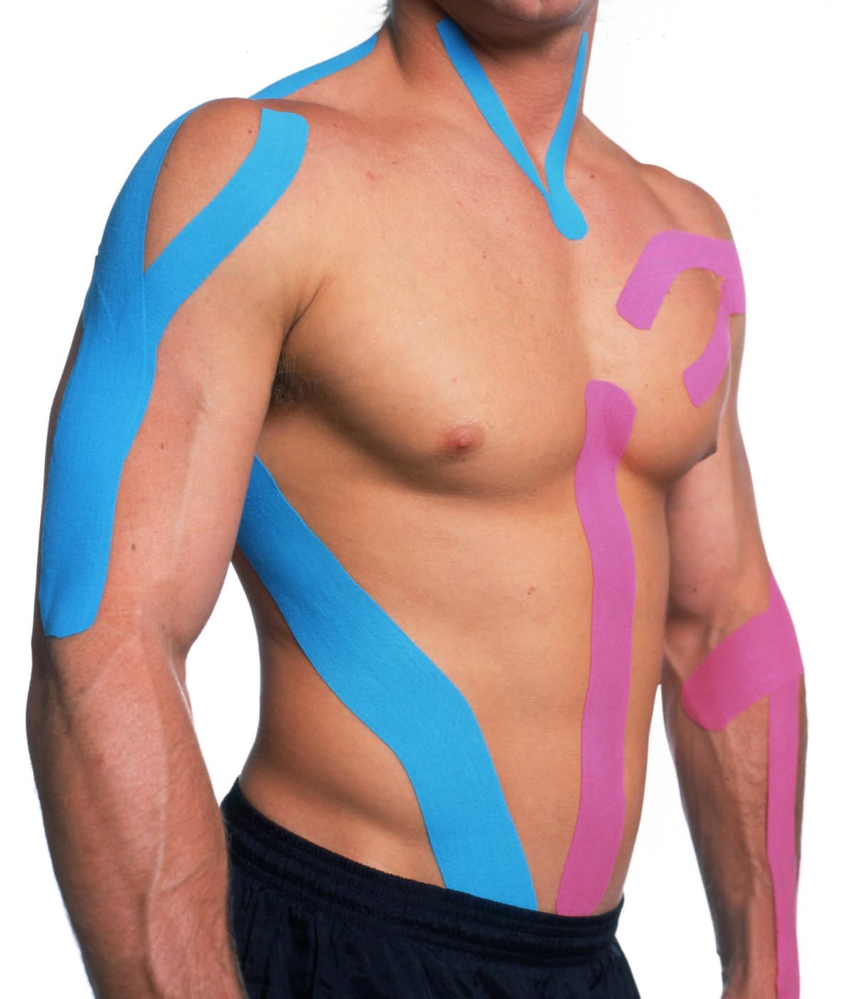 KINESIOTAPE UYGULAMALARI